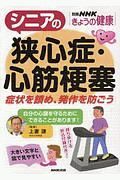 シニアの狭心症・心筋梗塞　症状を鎮め、発作を防ごう