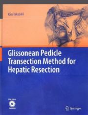 Ｇｌｉｓｓｏｎｅａｎ　Ｐｅｄｉｃｌｅ　Ｔｒａｎｓｅｃｔｉｏｎ　Ｍｅｔｈｏｄ　ｆｏｒ　Ｈｅｐａｔｉｃ　Ｒｅｓｅｃｔｉｏｎ