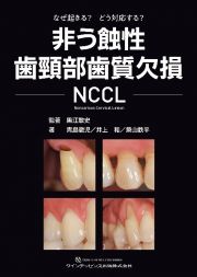 非う蝕性歯頚部歯質欠損　ＮＣＣＬ　なぜ起きる？どう対応する？