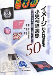 イメージからせまる　小児神経疾患５０