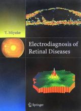 Ｅｌｅｃｔｒｏｄｉａｇｎｏｓｉｓ　ｏｆ　ｒｅｔｉｎａｌ　ｄｉｓｅａｓｅｓ