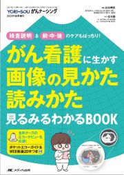 がん看護に生かす画像の見かた読みかた　見るみるわかるＢＯＯＫ　検査説明＆前・中・後のケアもばっちり！