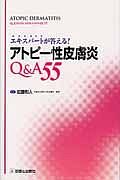 エキスパートが答える！アトピー性皮膚炎Ｑ＆Ａ５５