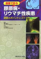 画像で診る膠原病・リウマチ性疾患