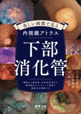 美しい画像で見る内視鏡アトラス　下部消化管