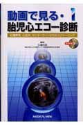 動画で見る・胎児心エコー診断　位置異常，心拡大，センターラインからのスクリーニング