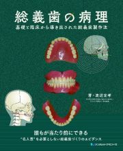 総義歯の病理　基礎と臨床から導き出された総義歯製作法