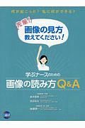 学ぶナースのための画像の読み方Ｑ＆Ａ