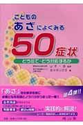 こどものあざによくみる５０症状