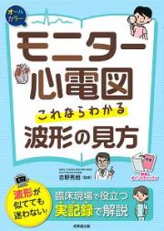 モニター心電図　これならわかる波形の見方