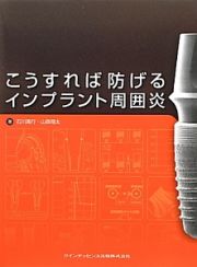 こうすれば防げるインプラント周囲炎