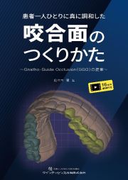 患者一人ひとりに真に調和した咬合面のつくりかた　ＧｎａｔｈｏーＧｕｉｄｅ　Ｏｃｃｌｕｓｉｏｎ（ＧＧＯ）の提案