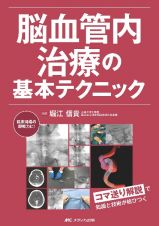 脳血管内治療の基本テクニック　コマ送り解説で知識と技術が結びつく