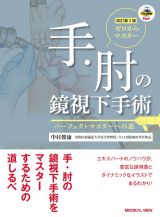 ゼロからマスター　手・肘の鏡視下手術