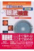 手にとるようにわかる健診のための眼底検査＜改訂版＞